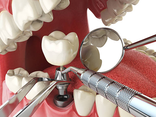 Best Holiday Emergency Dentist in Winter Gardens, CA